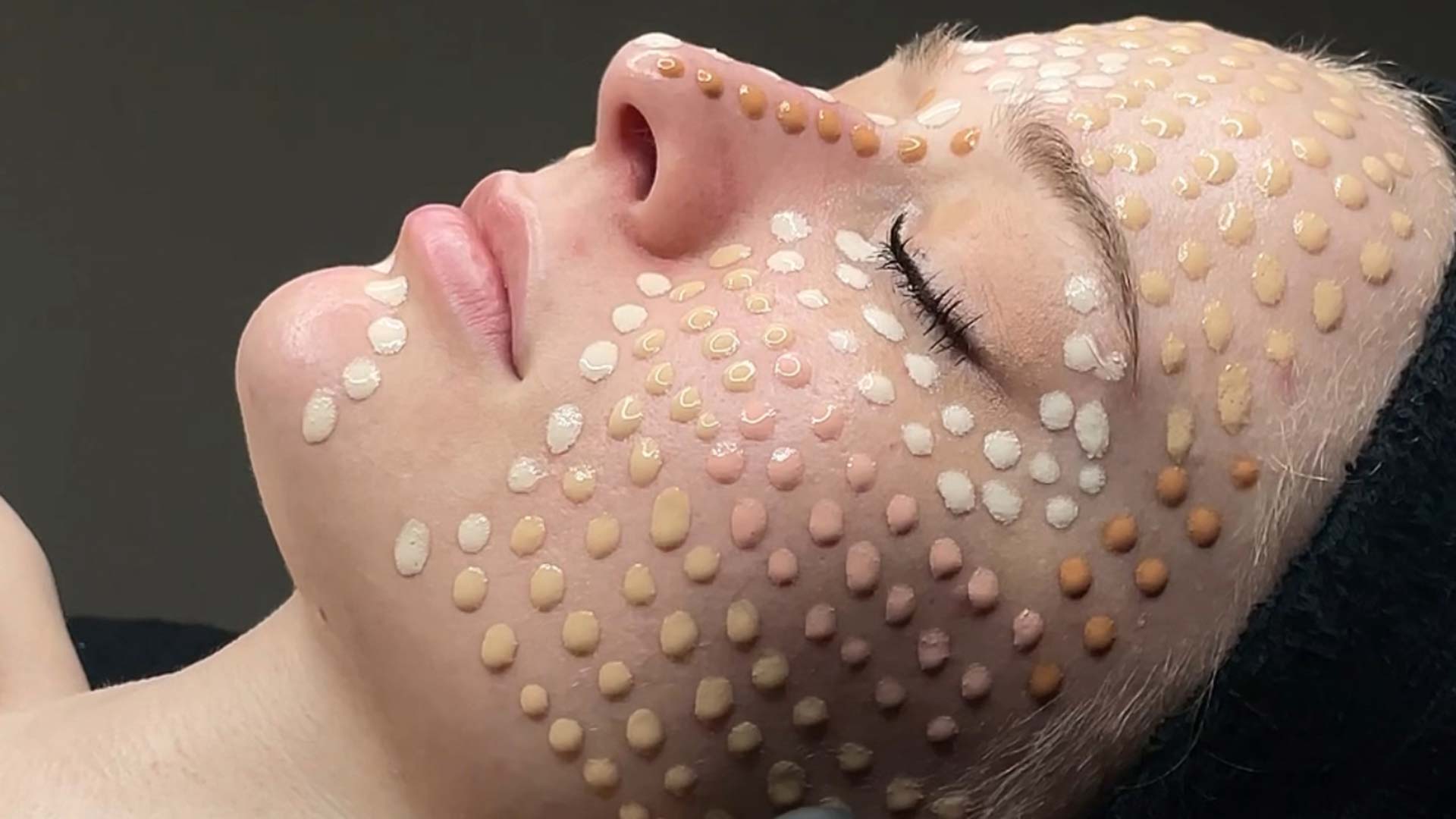 Gesicht einer Frau mit unterschiedlichen Concealer-Punkten, neutraler Ausdruck, nahaufnahme.
